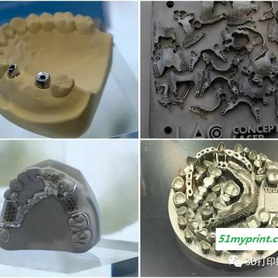 模具钢金属3D打印服务直接打印模芯